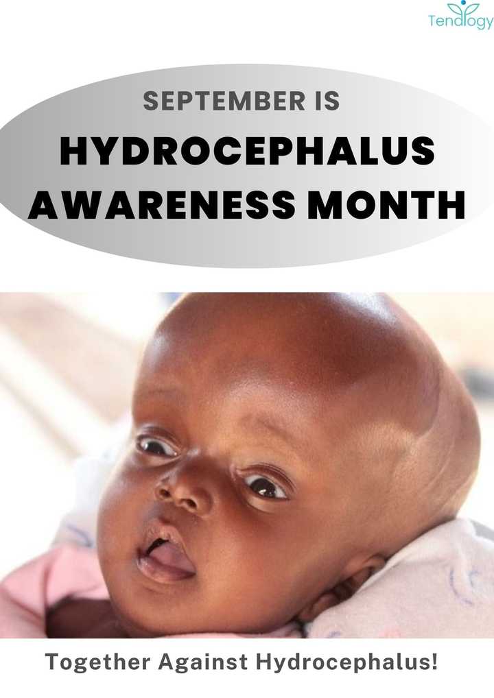 THW35-Hydrocephalus- Early Diagnosis Saves Lives!