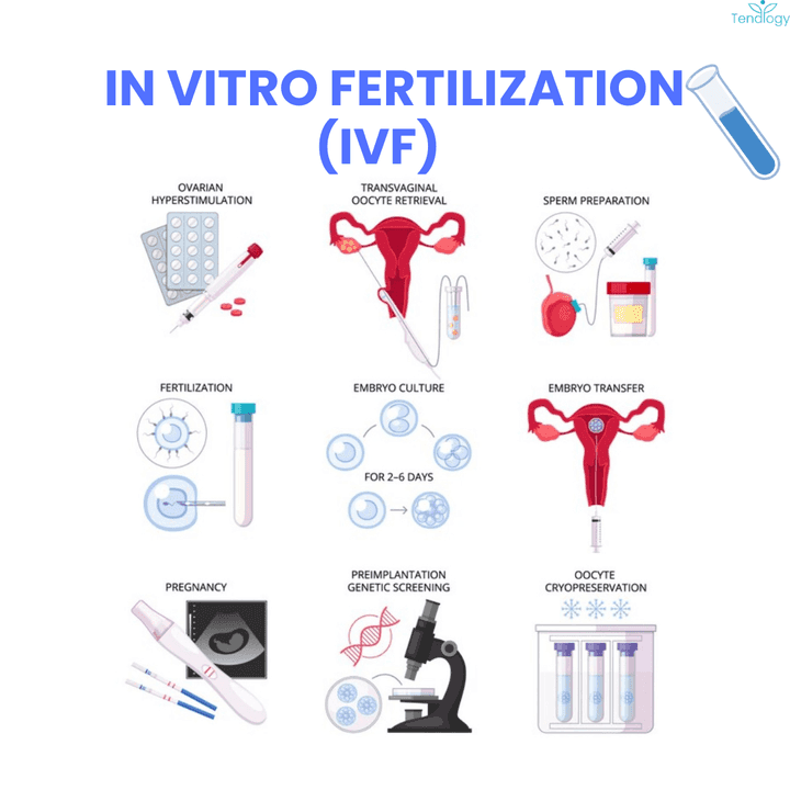 THW46-From Hope to Reality: Understanding In Vitro Fertilization (IVF)